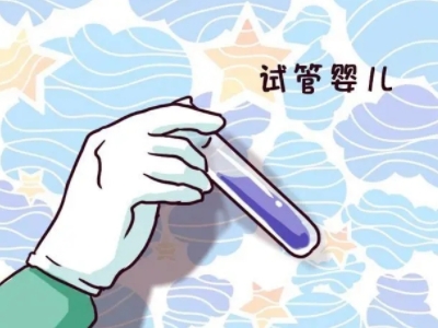 关于极光
